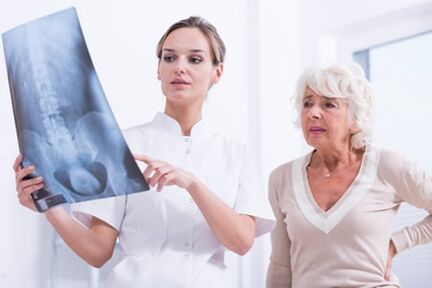 O exame de raios X é un método informativo para diagnosticar a osteocondrose da columna vertebral