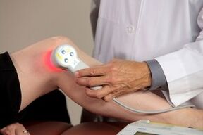 Procedementos de terapia con láser para a artrose das articulacións