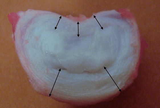 Como é un disco intervertebral