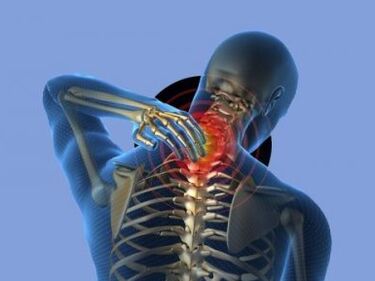 Unha persoa con osteocondrose da columna cervical experimenta dor no pescozo